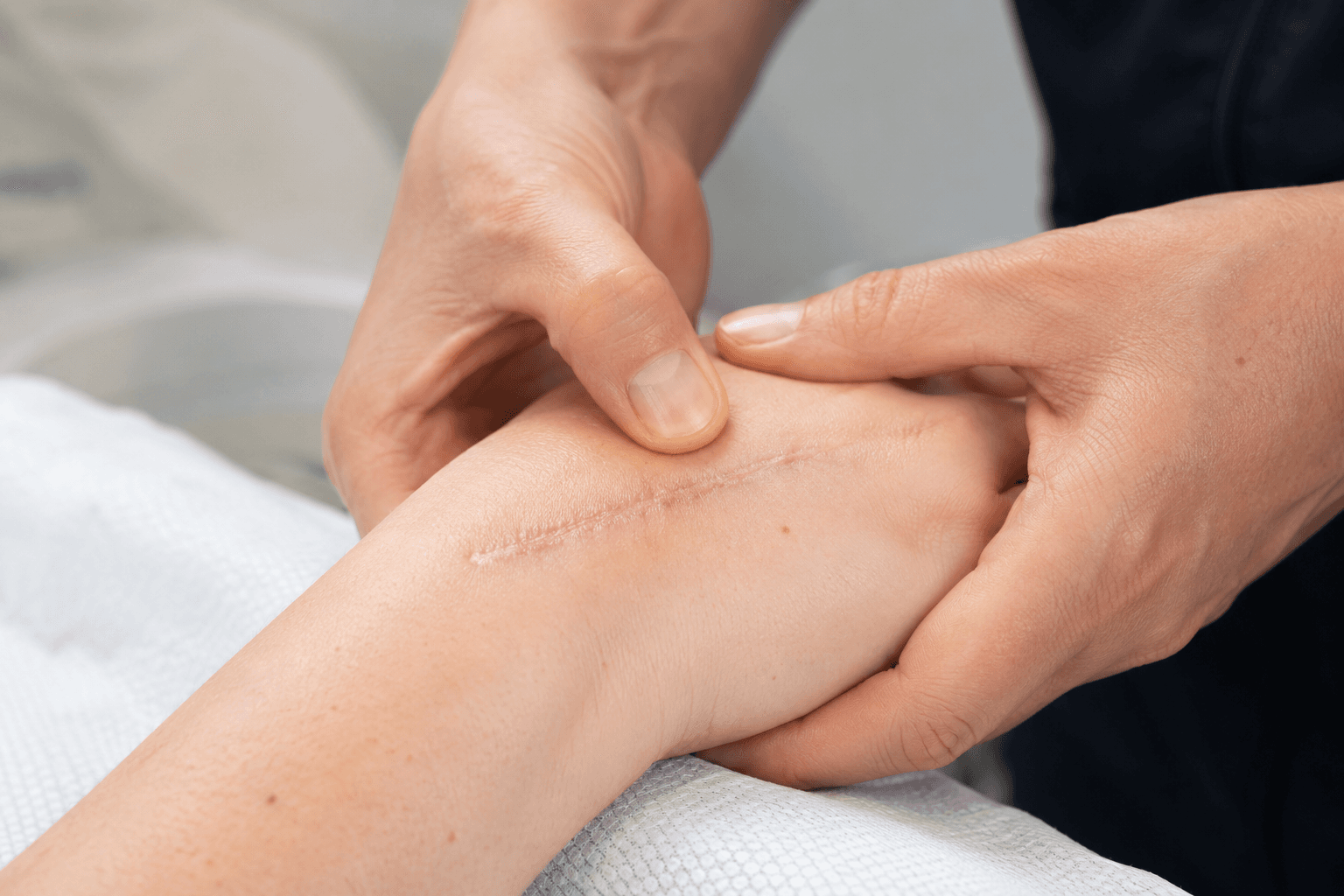 Ergotherapeutin behandelt eine Narbe an der Hand